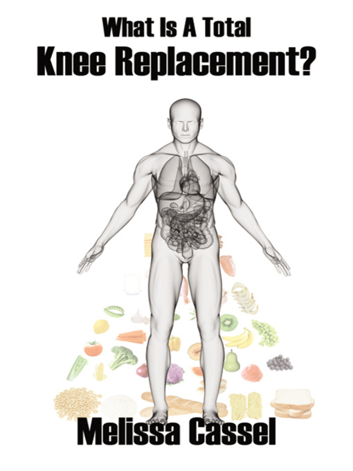 Title details for What Is A Total Knee Replacement? by Melissa Cassel - Available